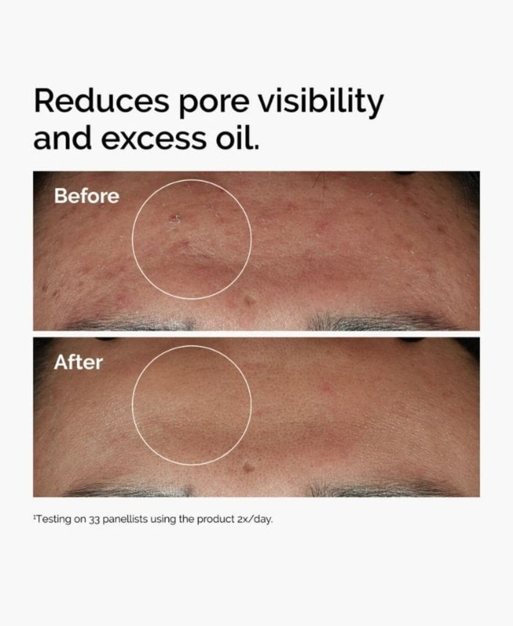 Ordinary 10 percent niacinmide +1 percent zinc serum 30 ml Delivery Free
