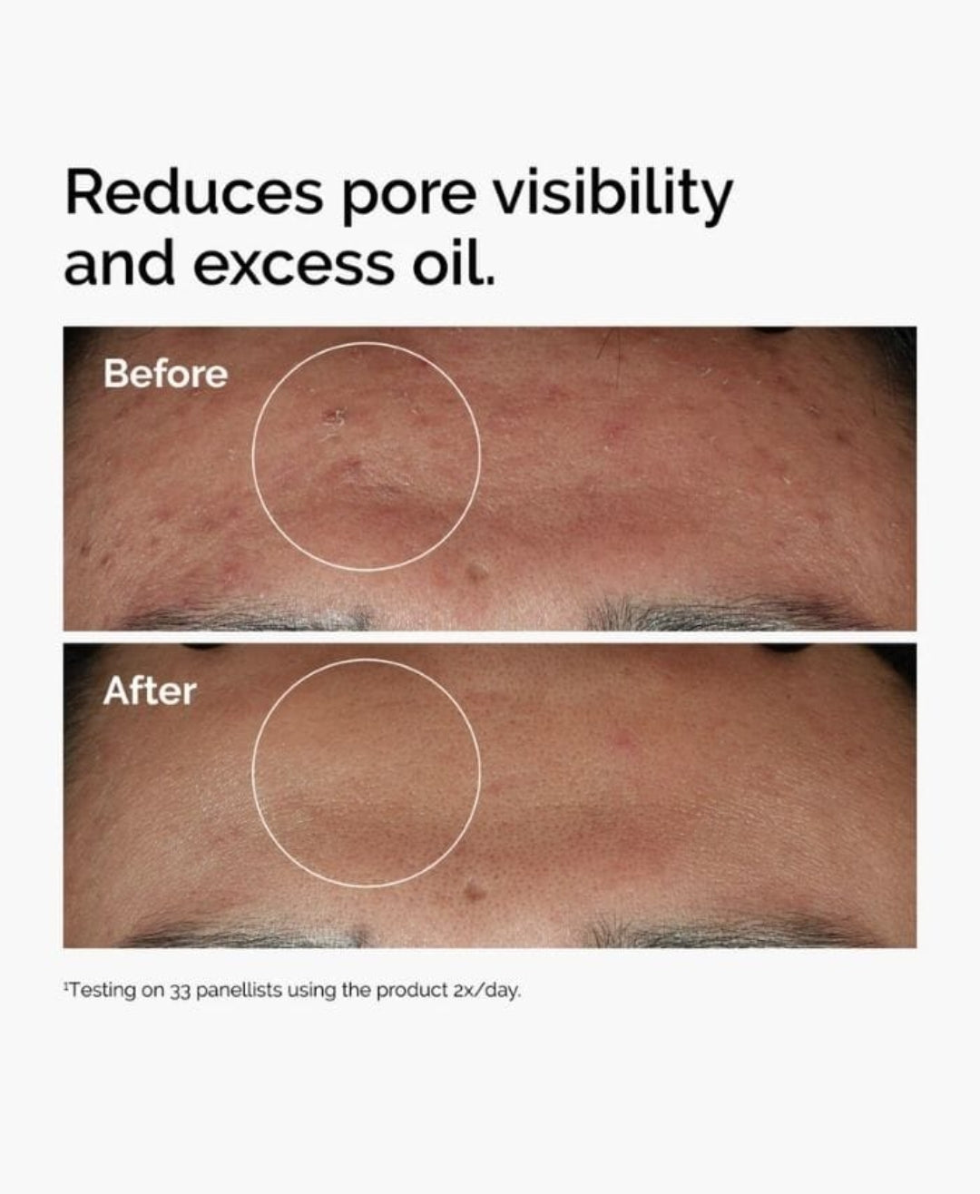 Ordinary 10 percent niacinmide +1 percent zinc serum 30 ml Delivery Free